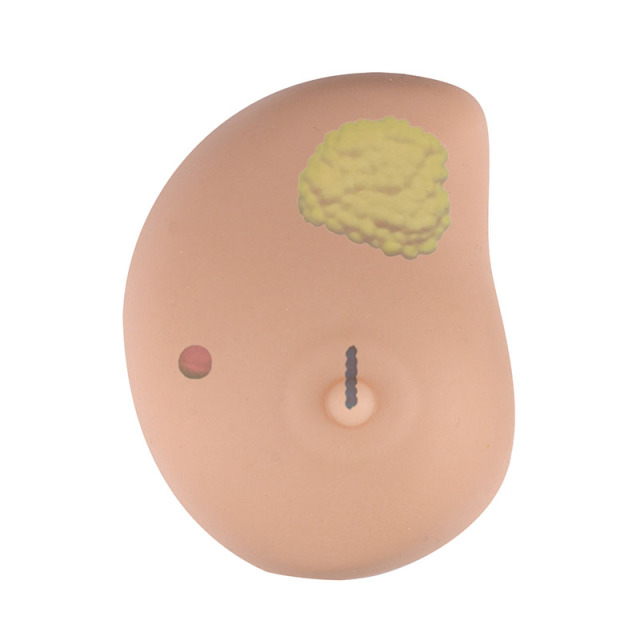 Breast Self Exam(BSE) Model with Irregular Masses
