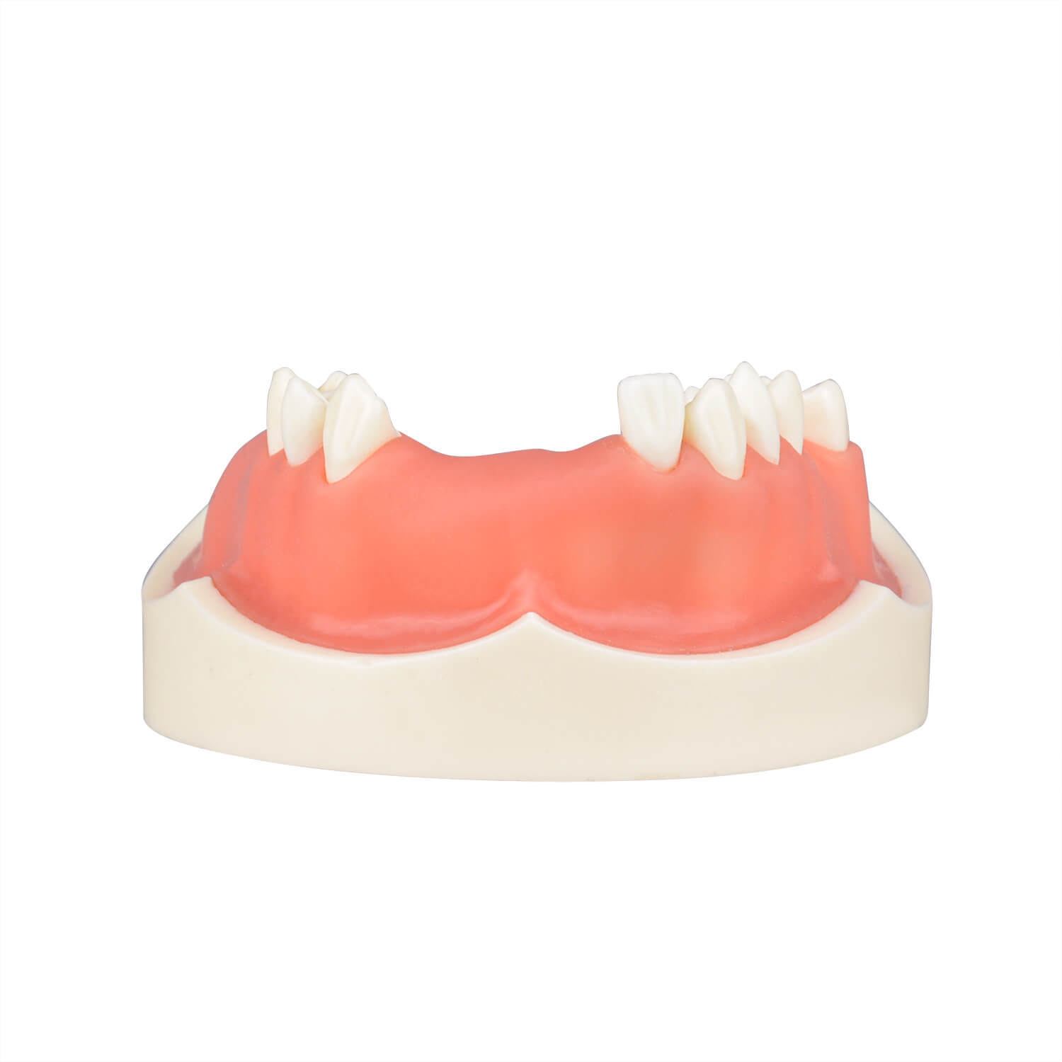 Maxillary Implant Surgery Practice Model, Missing 17, 12, 11, 21, 22, 26, 27 Teeth