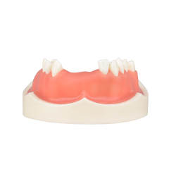 Maxillary Implant Surgery Practice Model, Missing 17, 12, 11, 21, 22, 26, 27 Teeth