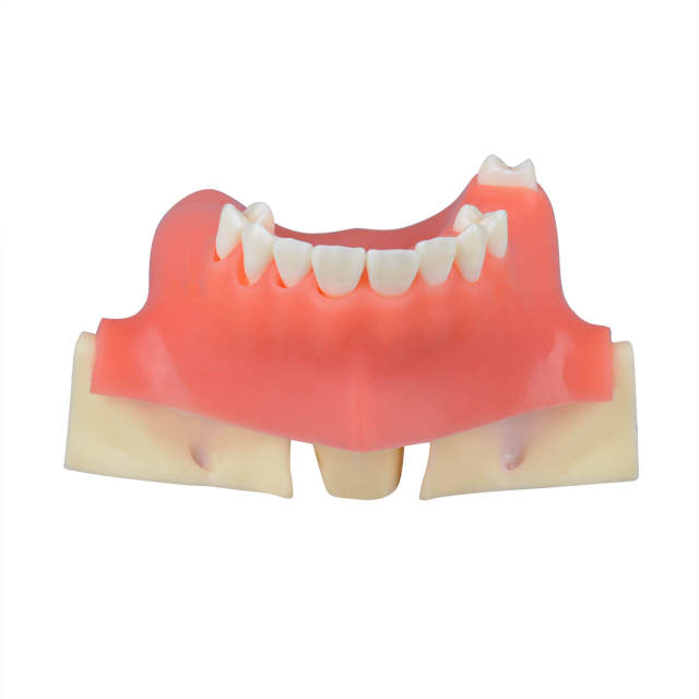 Implant Surgery Maxillary Sinus Lift Model for Training, Missing Teeth 15, 16, 25, 26, 27