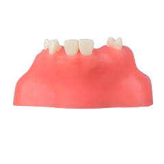 Maxillary Sinus Lift Surgery Implant Practice Model, Missing Teeth 12, 13, 15, 16, 17, 22, 25, 26, 27