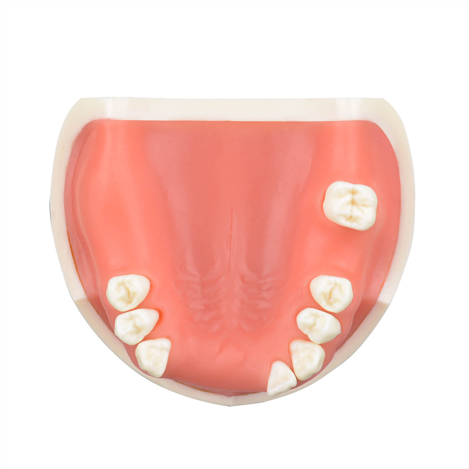 Maxillary Implant Surgery Practice Model, Missing 17, 12, 11, 21, 22, 26, 27 Teeth