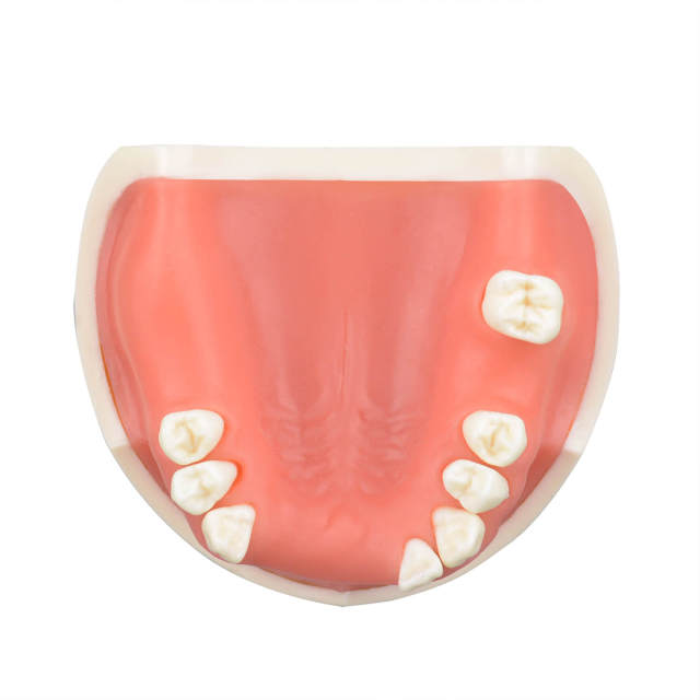 Maxillary Implant Surgery Practice Model, Missing 17, 12, 11, 21, 22, 26, 27 Teeth
