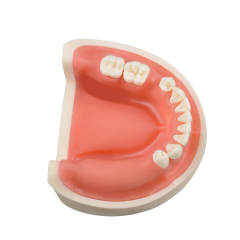 Human Mandible Implant Training Model Missing 47, 46, 45, 35 Teeth