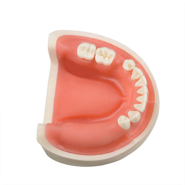Human Mandible Implant Training Model Missing 47, 46, 45, 35 Teeth