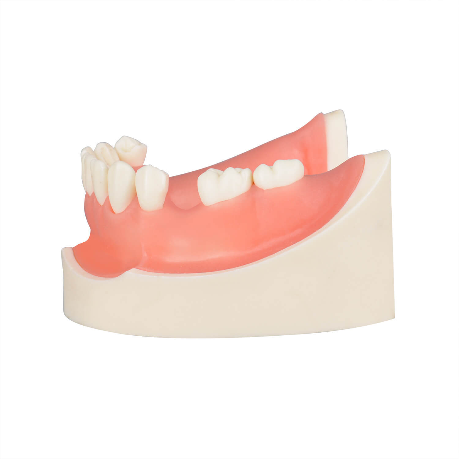 Human Mandible Implant Training Model Missing 47, 46, 45, 35 Teeth