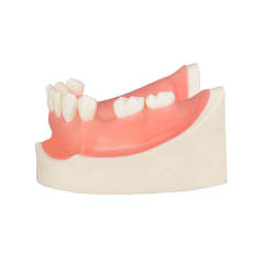 Human Mandible Implant Training Model Missing 47, 46, 45, 35 Teeth