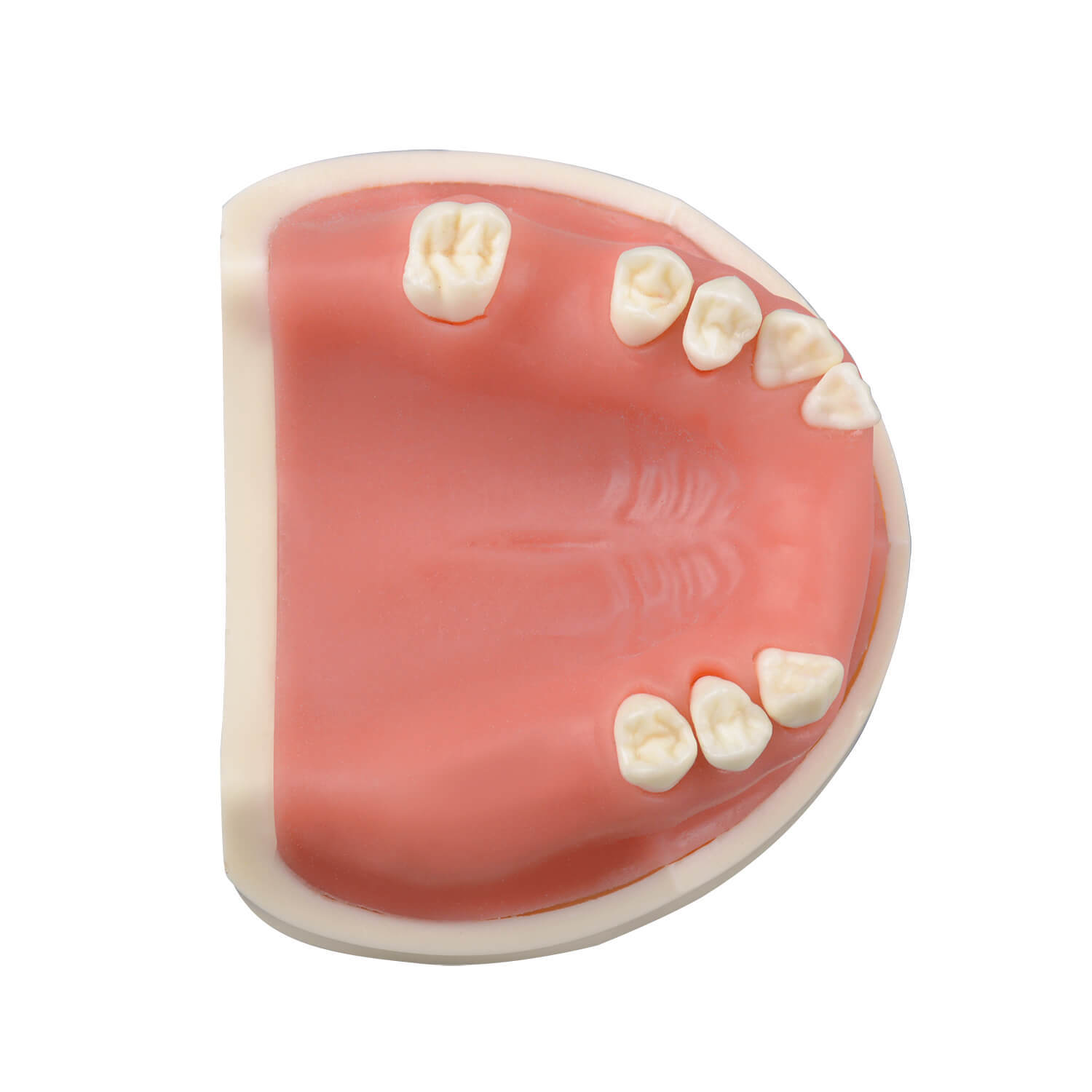 Maxillary Implant Surgery Practice Model, Missing 17, 12, 11, 21, 22, 26, 27 Teeth