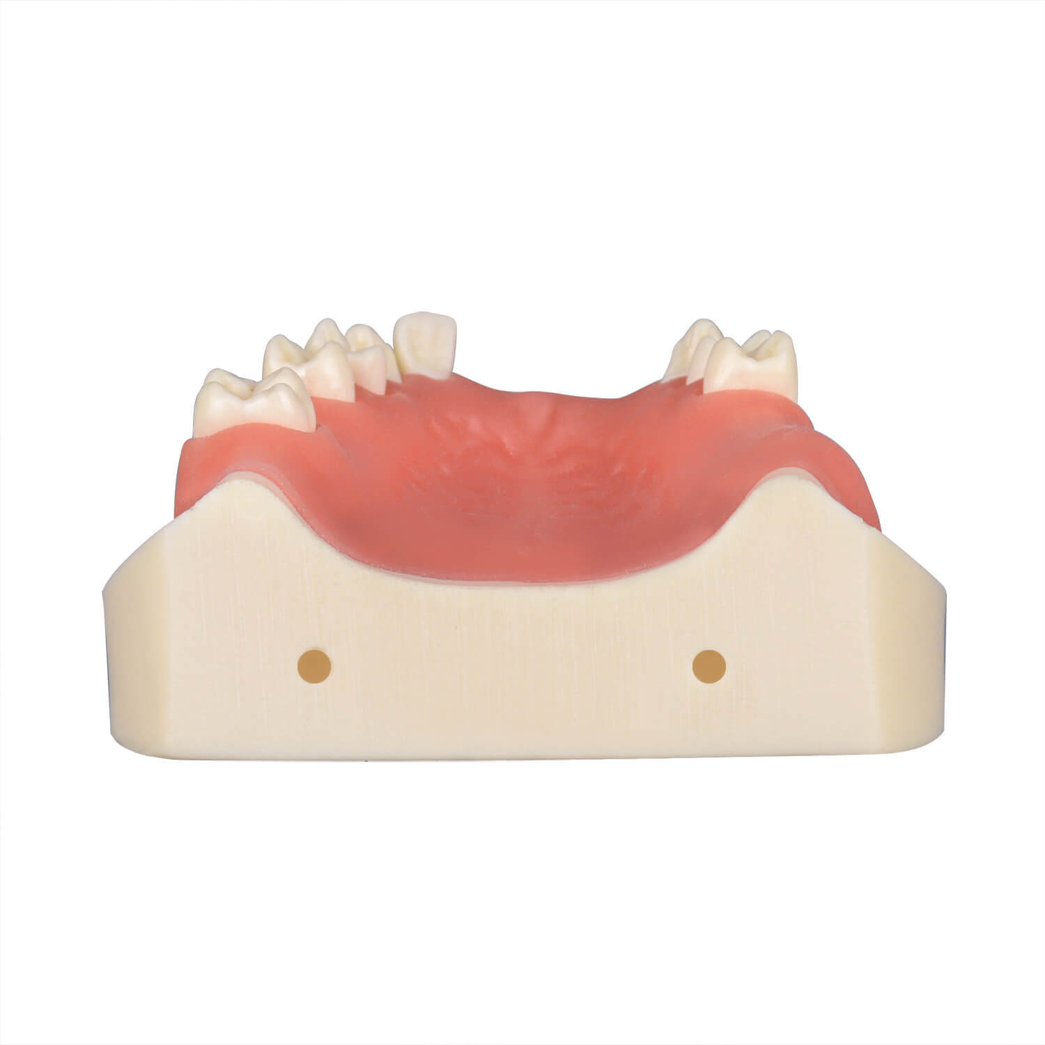 Maxillary Implant Surgery Practice Model, Missing 17, 12, 11, 21, 22, 26, 27 Teeth