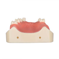 Maxillary Implant Surgery Practice Model, Missing 17, 12, 11, 21, 22, 26, 27 Teeth