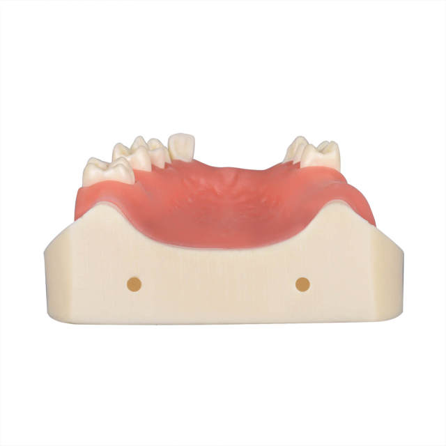 Maxillary Implant Surgery Practice Model, Missing 17, 12, 11, 21, 22, 26, 27 Teeth