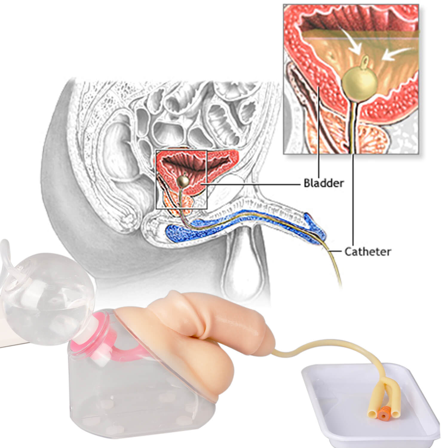 Male Urinary Catheterization Model