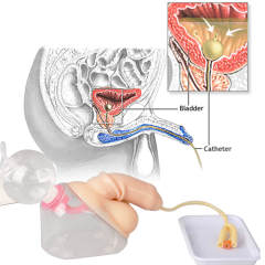 Male Urinary Catheterization Model