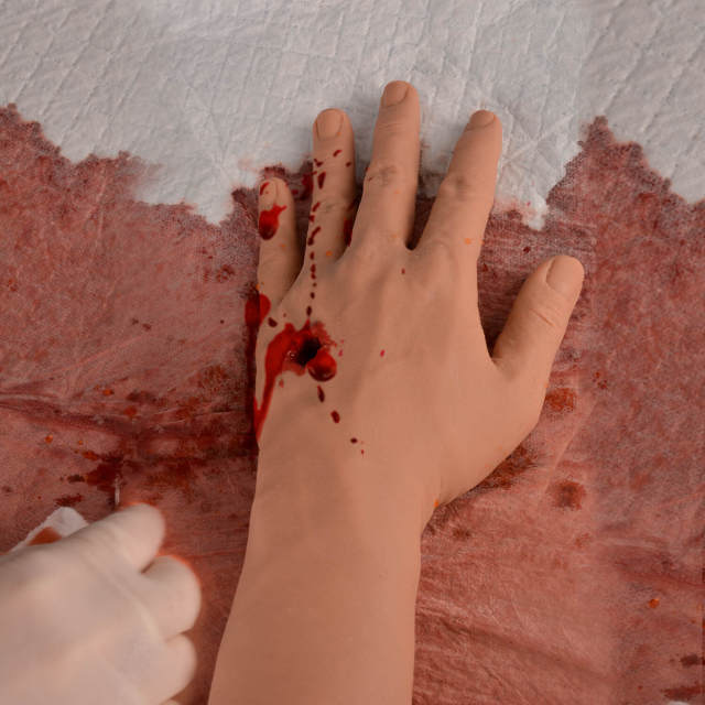 Gunshot Wound Hand Model for Tourniquet and Wound Packing Training
