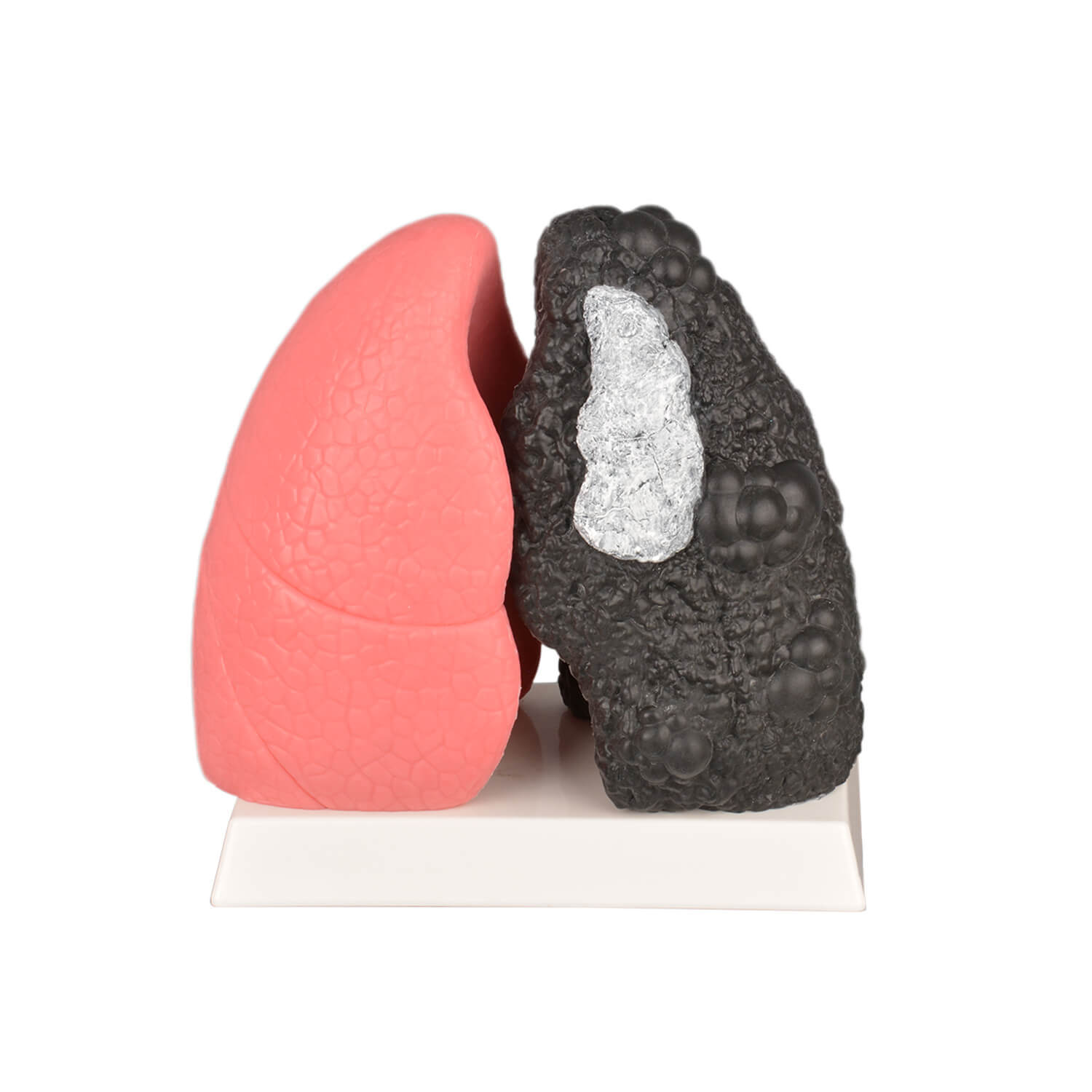 Healthy and Smokers Lung Model, Small and Large Size