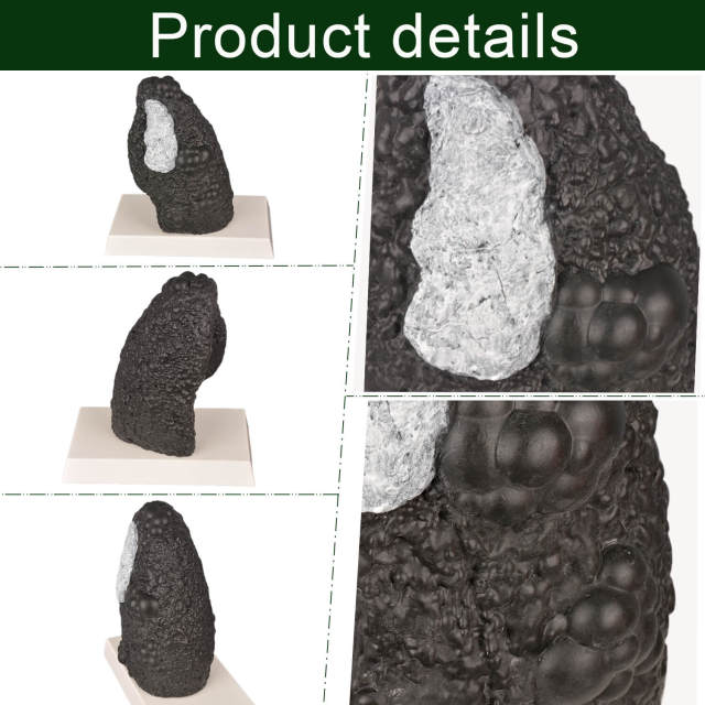 Healthy and Smokers Lung Model, Small and Large Size