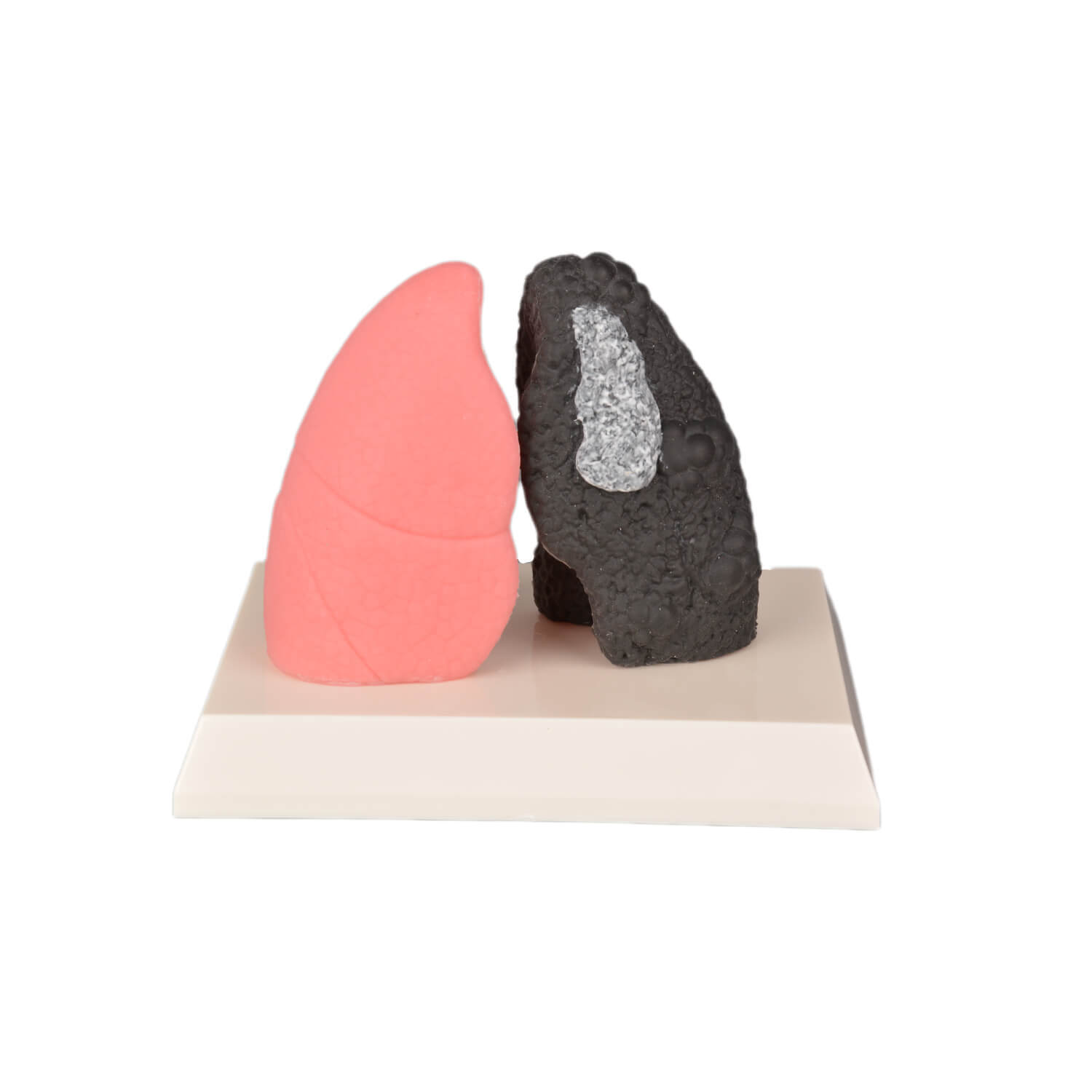 Healthy and Smokers Lung Model, Small and Large Size