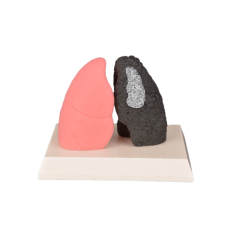 Healthy and Smokers Lung Model, Small and Large Size