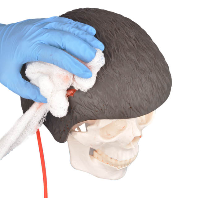 Open Scalp Wound Moulage, Brown and Dark Skin