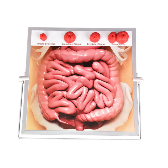 Tabletop & Hanging Ostomy Model Kit
