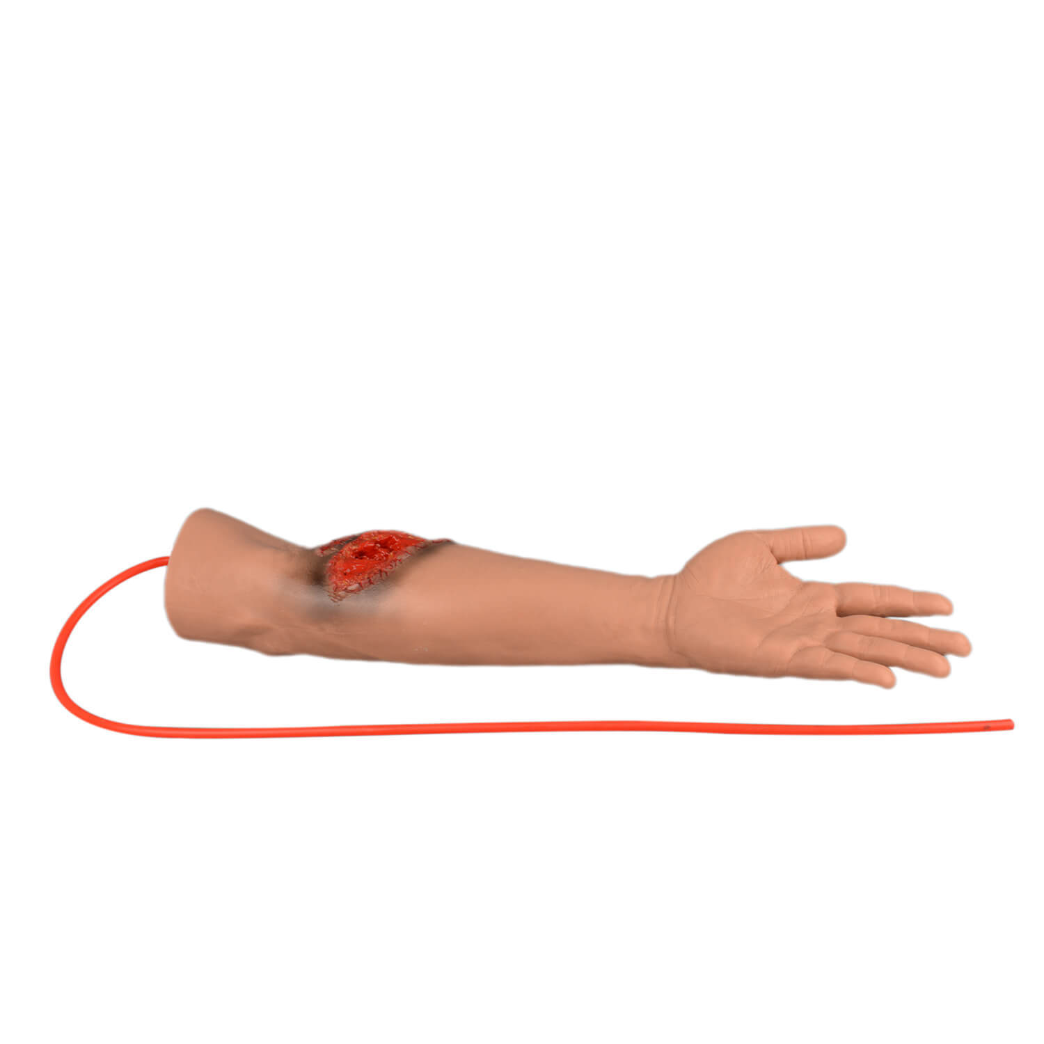 Trauma Arm with Bleeding Laceration Wound