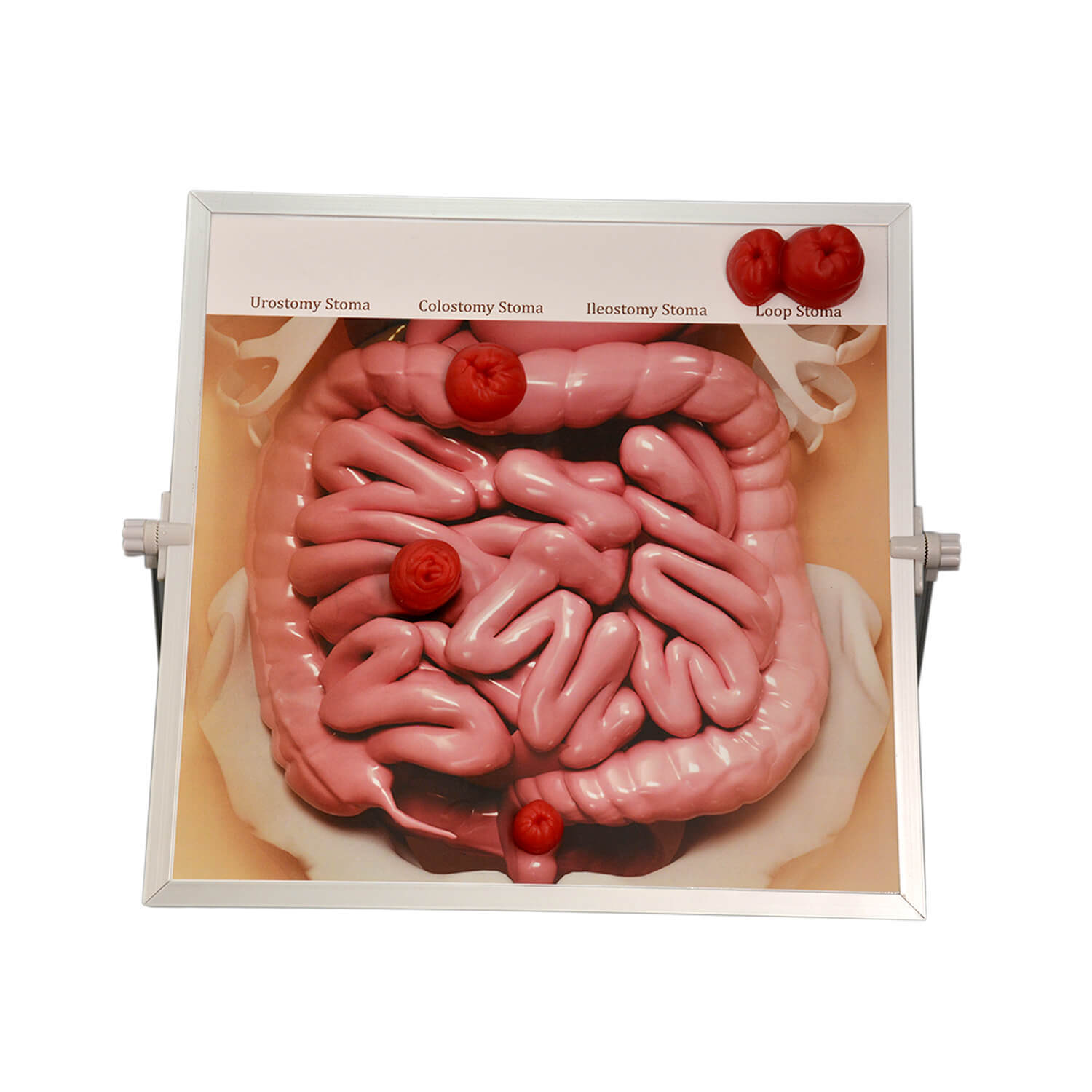 Tabletop & Hanging Ostomy Model Kit