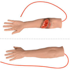 Trauma Arm with Bleeding Laceration Wound