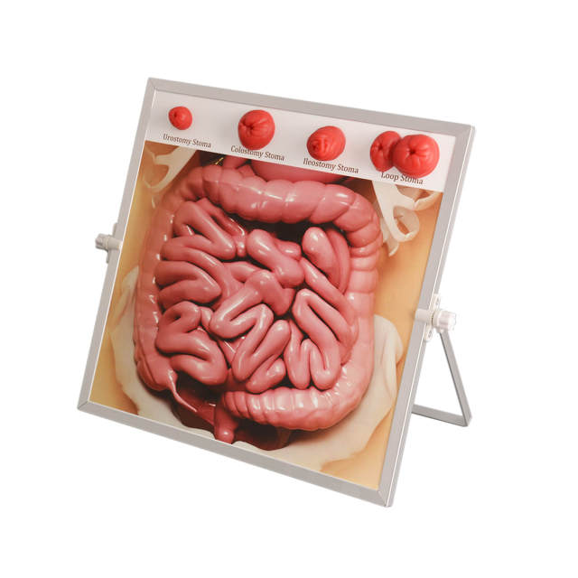 Tabletop & Hanging Ostomy Model Kit