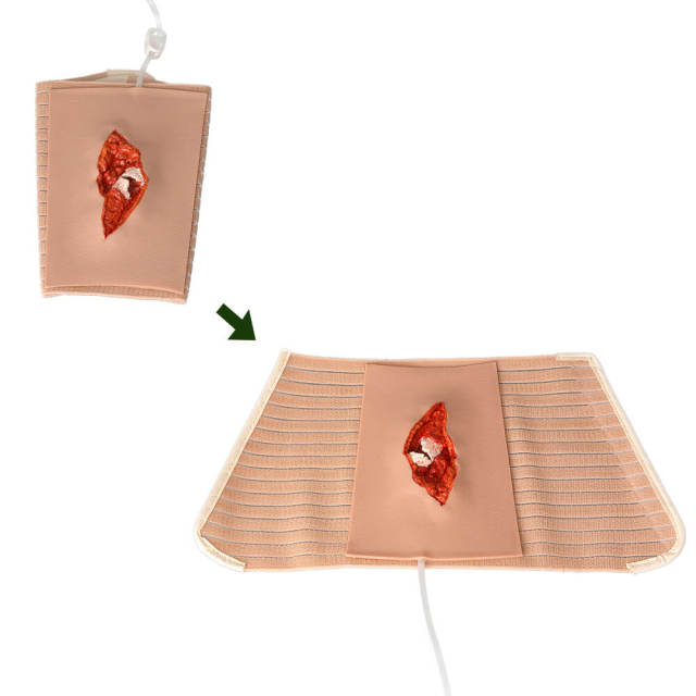 Wearable Open Fracture Wound Packing Trainer, Ⅱ, Ⅲ, Ⅳ, Ⅴ