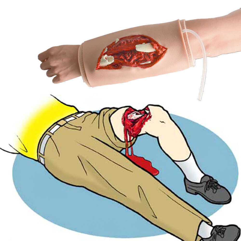 Wearable Open Fracture Wound Packing Trainer, Ⅱ, Ⅲ, Ⅳ, Ⅴ