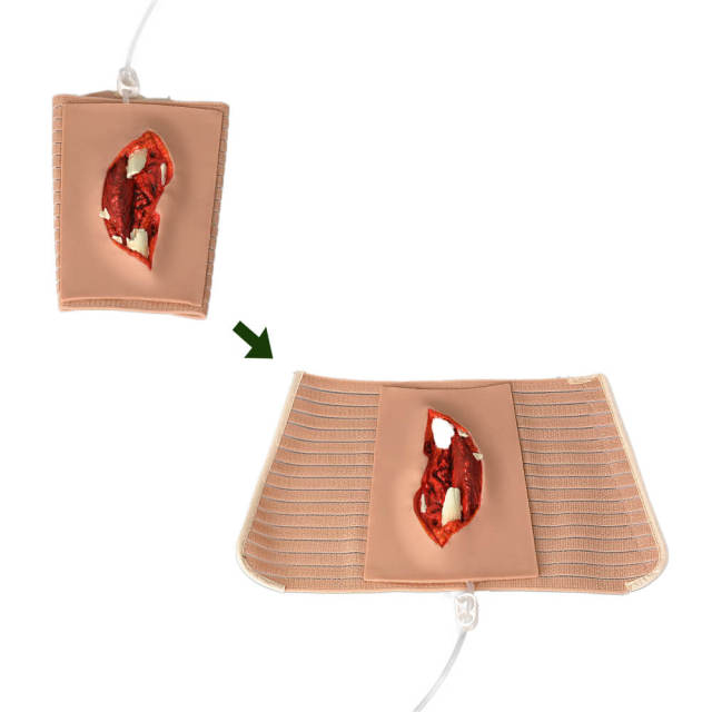 Wearable Open Fracture Wound Packing Trainer, Ⅱ, Ⅲ, Ⅳ, Ⅴ