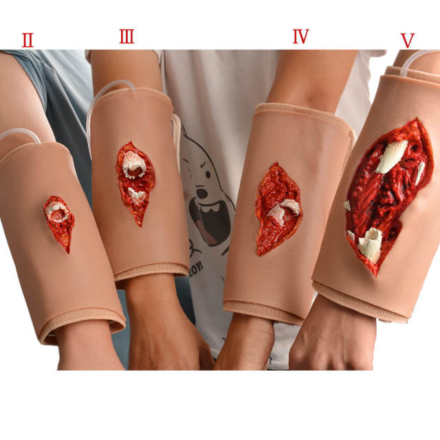 Wearable Open Fracture Wound Packing Trainer, Ⅱ, Ⅲ, Ⅳ, Ⅴ