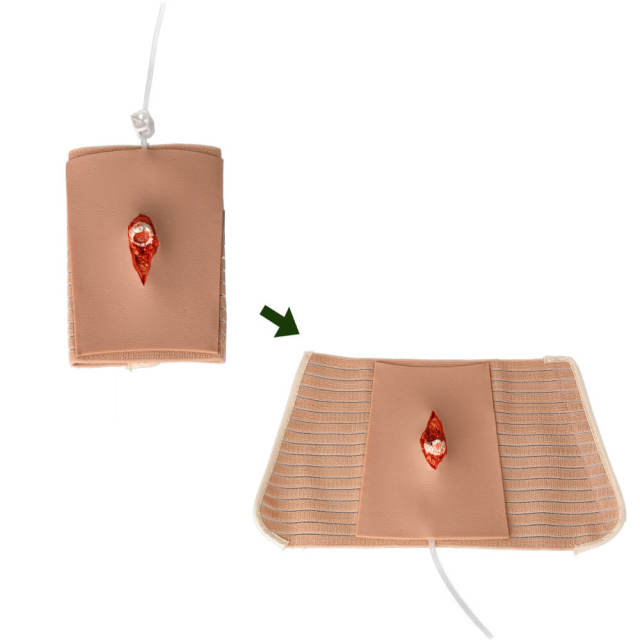 Wearable Open Fracture Wound Packing Trainer, Ⅱ, Ⅲ, Ⅳ, Ⅴ