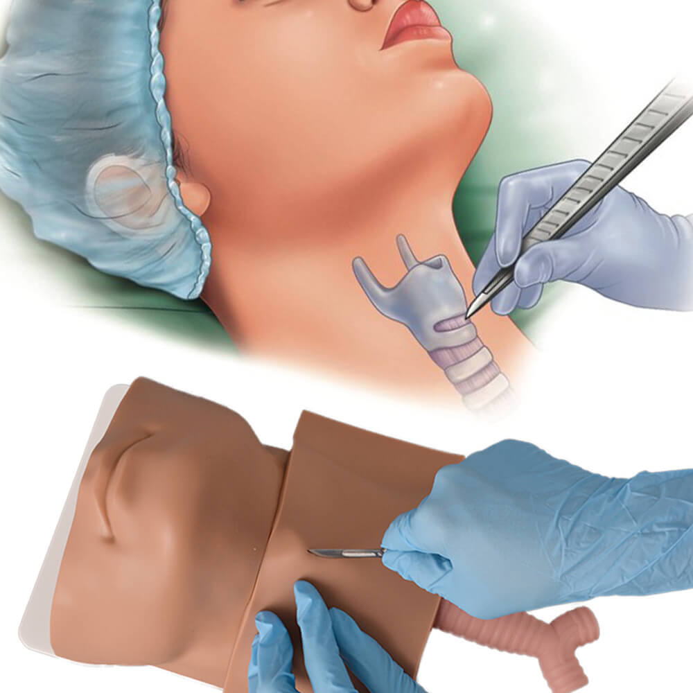 Cricothyrotomy Task Trainer for Emergency Airway Management