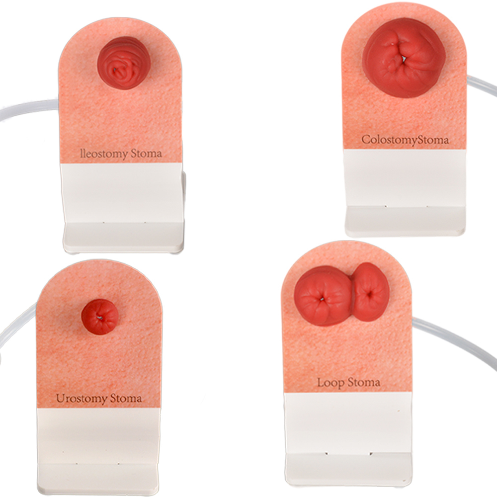 sticky ostomy stoma care training models set