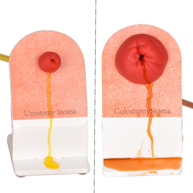 different types of ostomy care model for demonstration