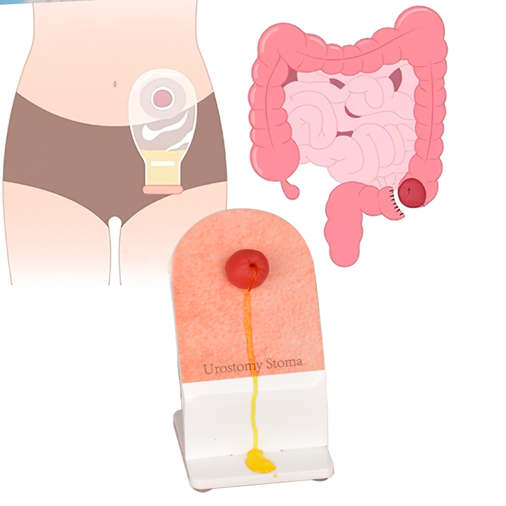 ostomy care model for demonstration