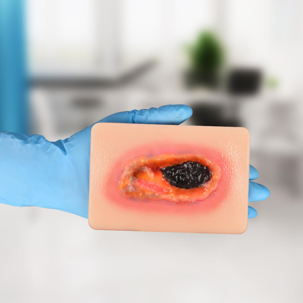 Pocket Necrotic Tissue Wound Card Model, 3 Types