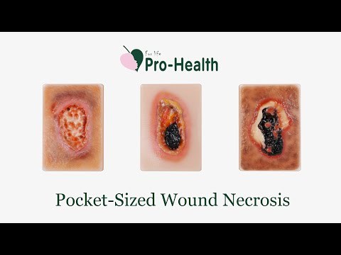Pocket Necrotic Tissue Wound Card Model, 3 Types