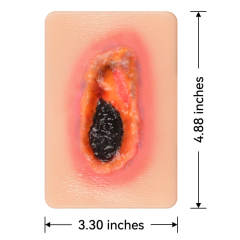 Pocket Necrotic Tissue Wound Card Model, 3 Types