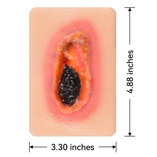 Pocket Necrotic Tissue Wound Card Model, 3 Types