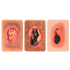 Pocket Necrotic Tissue Wound Card Model, 3 Types
