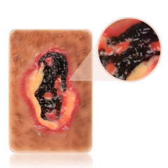 Pocket Necrotic Tissue Wound Card Model, 3 Types