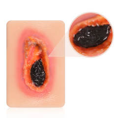 Pocket Necrotic Tissue Wound Card Model, 3 Types