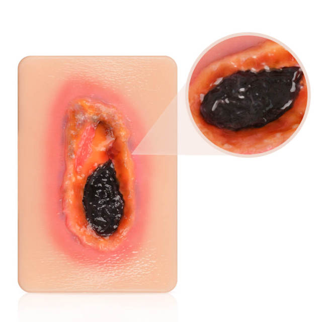 Pocket Necrotic Tissue Wound Card Model, 3 Types