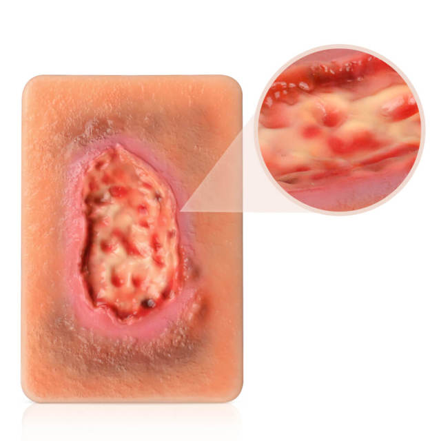 Pocket Necrotic Tissue Wound Card Model, 3 Types