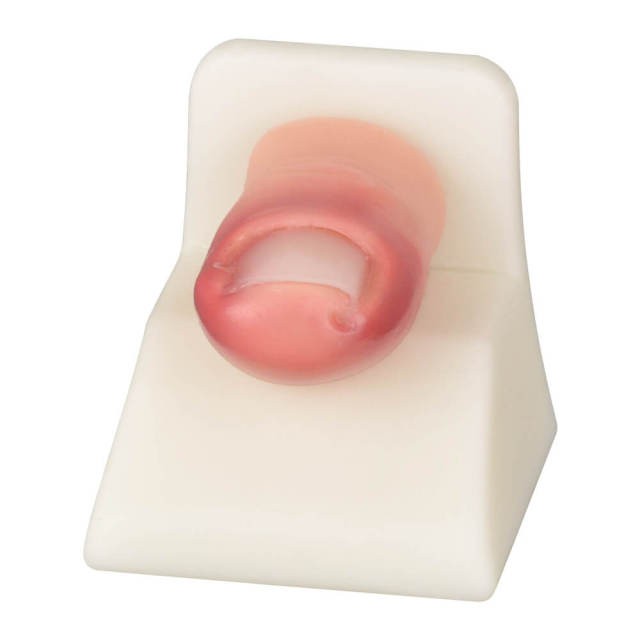Detachable Ingrown Toenail Trainer with Base