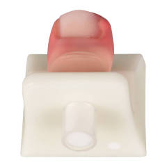 Detachable Ingrown Toenail Trainer with Base