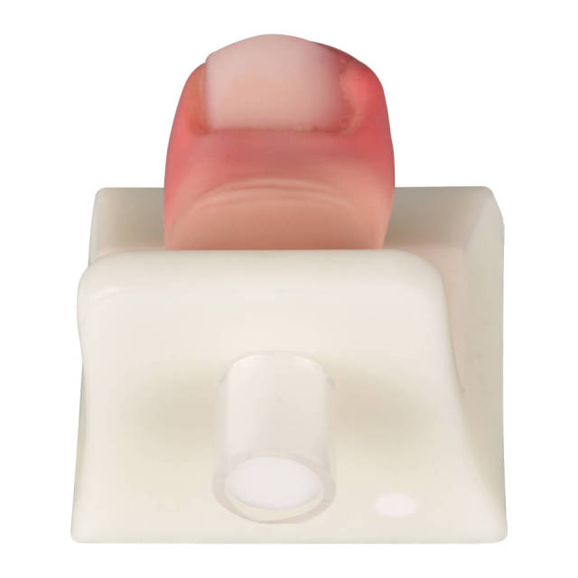Detachable Ingrown Toenail Trainer with Base