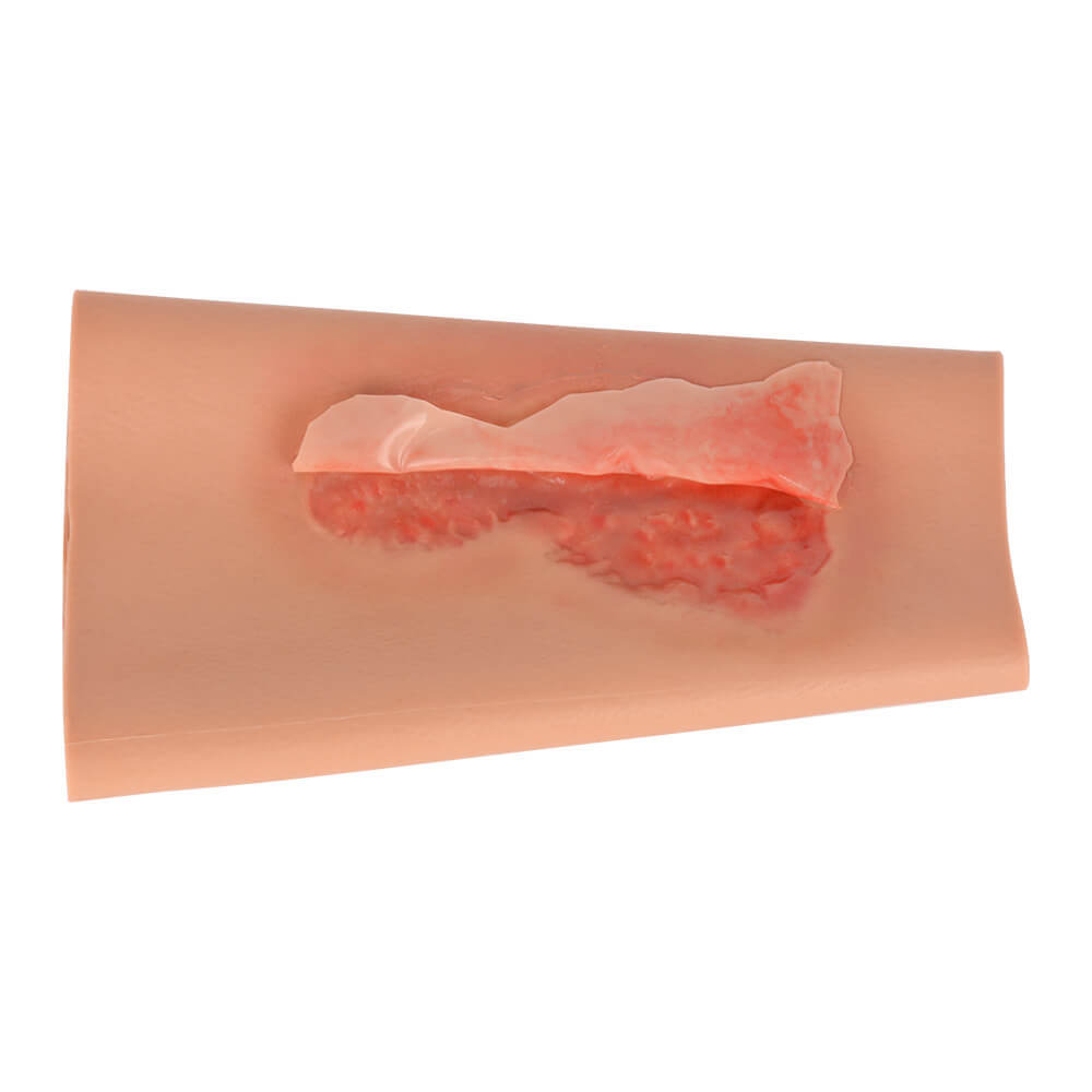 Abrasion Wound Care Simulation Sleeve